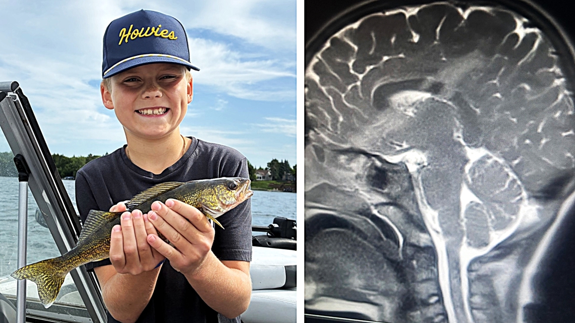9 year old MN boy survives arrow - C8c002a8 B84c 4760 B1ad D96c47da9ff6 1140x641 