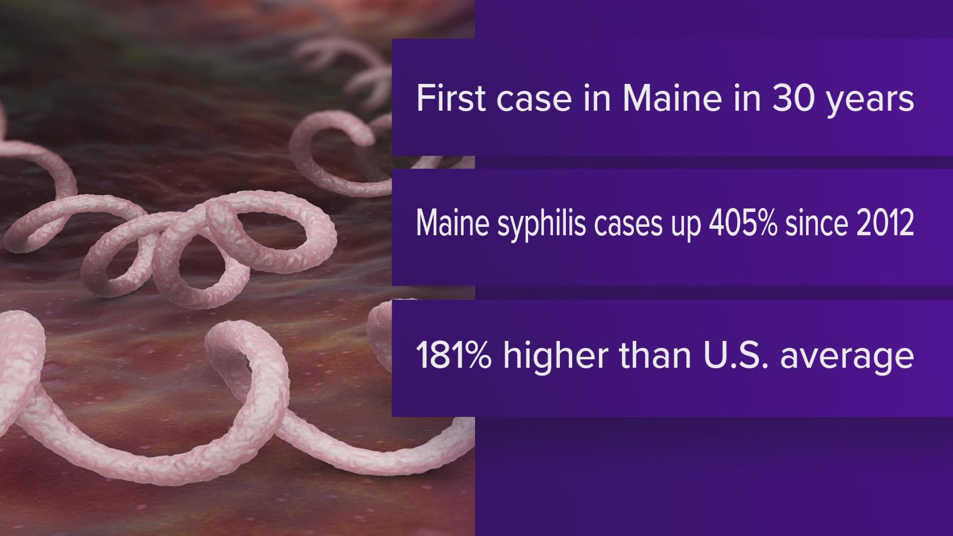 Syphilis rates have been on the rise in Maine since 2012. During that time, cases went up by 405%, which is close to 200% higher than national average.