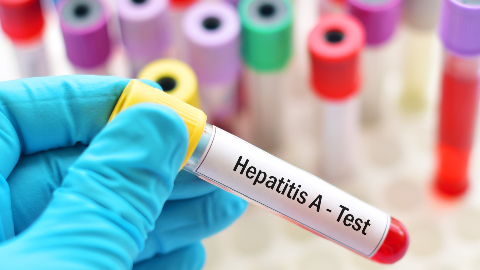 Health officials are encouraging people who ate at Legends Rest Taproom or Paper City BBQ to get tested.