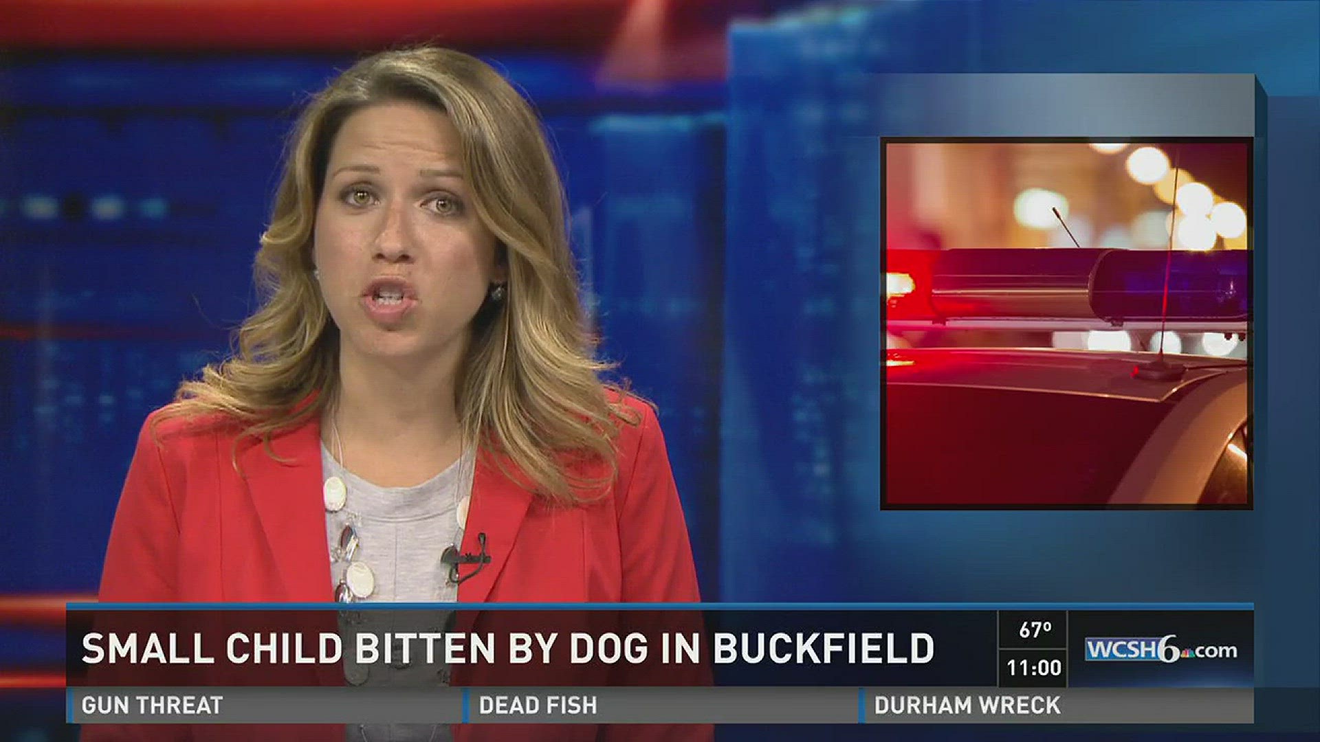 Oneyearold child bitten by dog in Buckfield