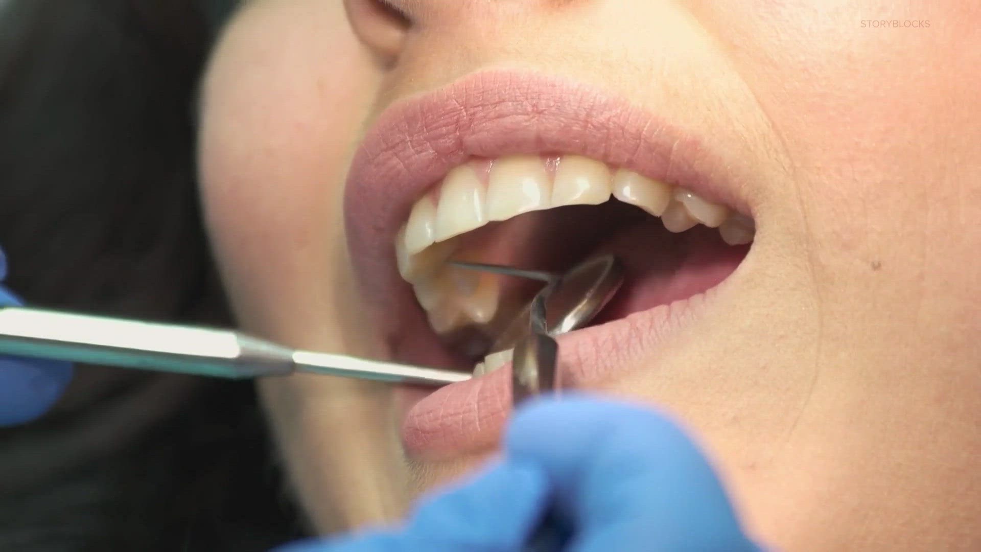 why-you-should-wait-30-minutes-after-eating-to-brush-your-teeth