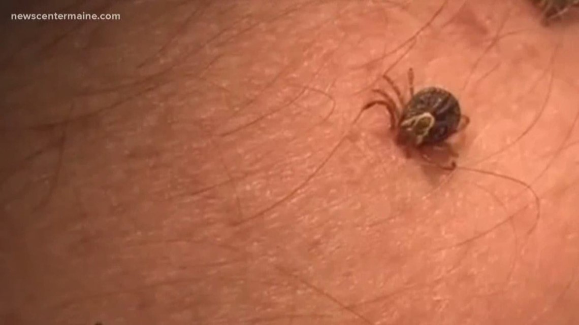 Maine doctor administers post-Lyme disease alternative treatments