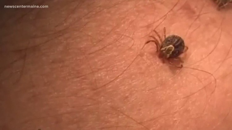 Patients with post-Lyme disease flocking to alternative treatments