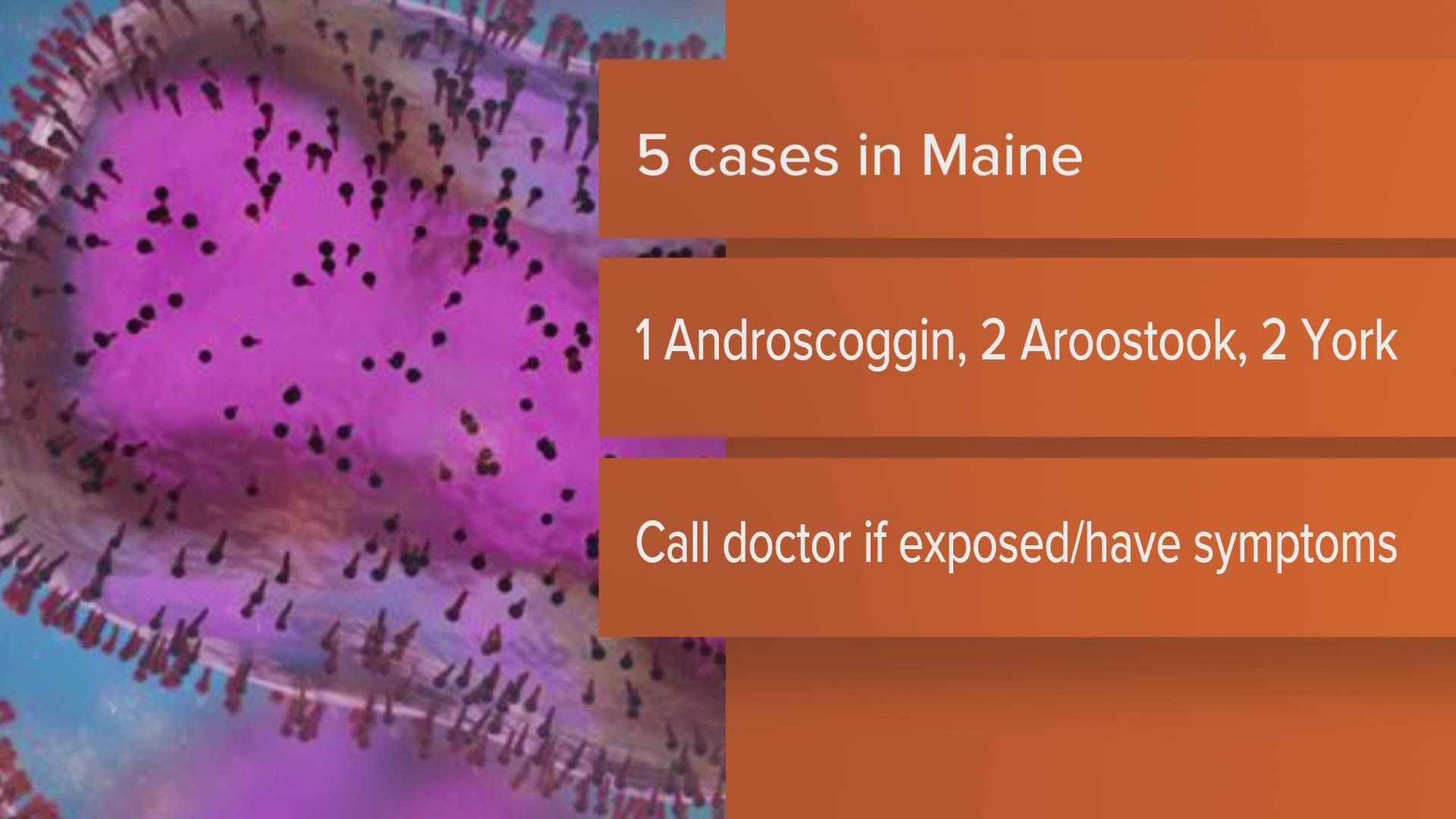 Two cases have been reported in York County, two in Aroostook County, and one in Androscoggin County.
