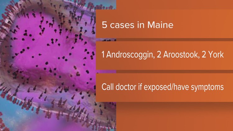 Maine CDC reports five cases of monkeypox