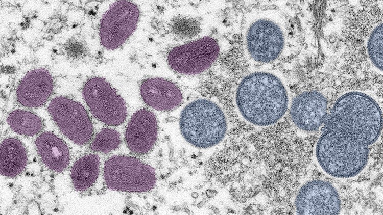 Maine CDC, community organizations squash stigma around monkeypox