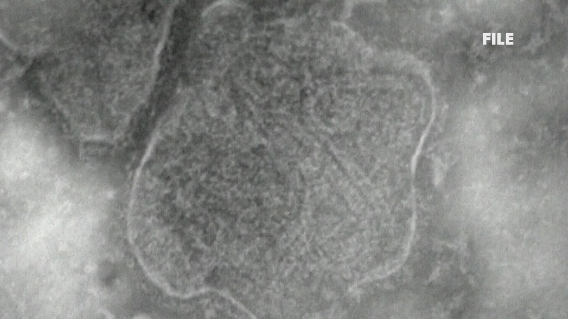 Measles concerns rise in Penobscot County as Maine CDC confirms 4 new unvaccinated cases