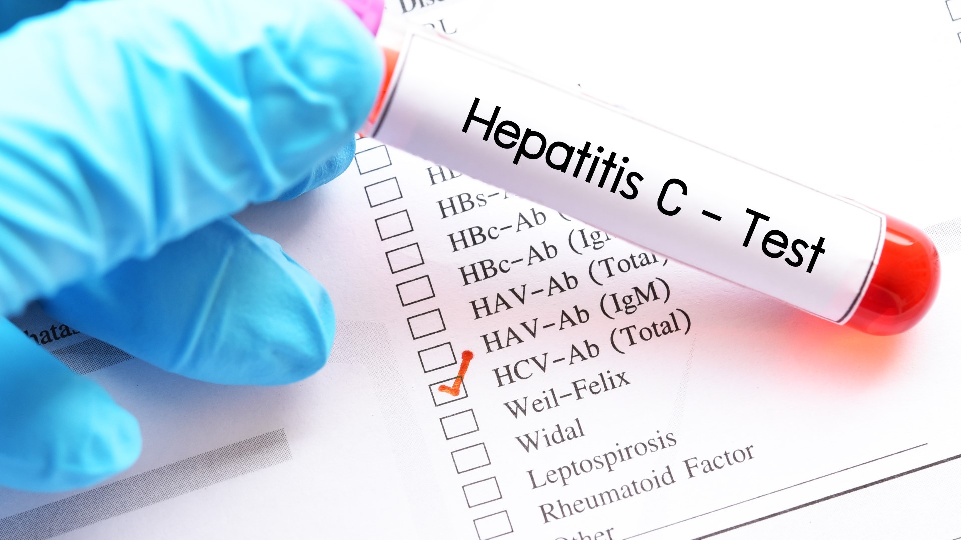 Hepatitis is a condition where the liver becomes inflamed. According to new data, the cases of hepatitis C nearly quadrupled in Maine between 2019 and 2020.