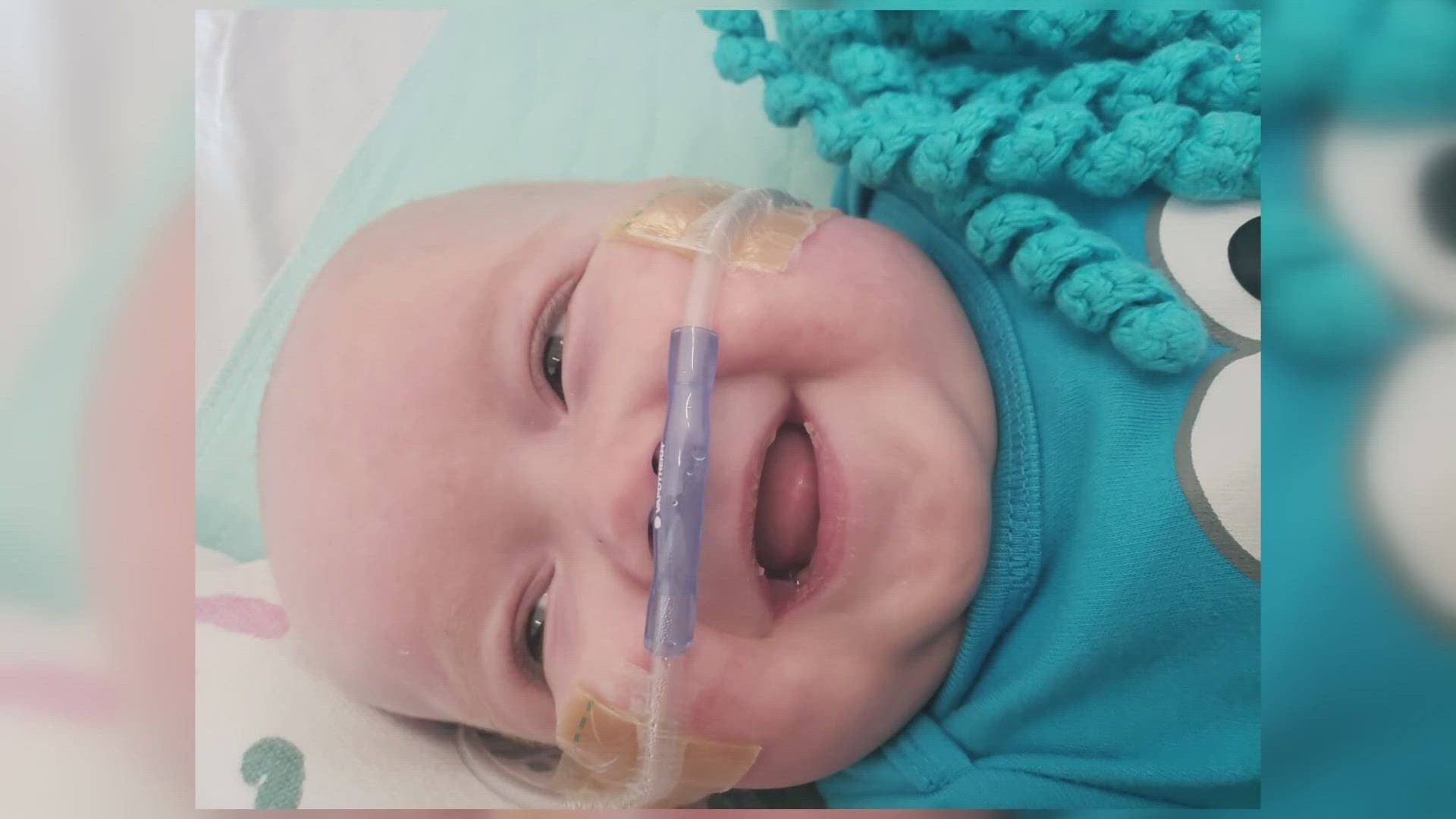 Cody Simmons, who just turned one year old, has spent nearly all of his life in the hospital.