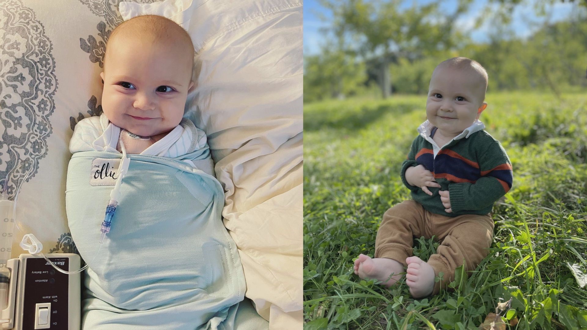 James was born without the protein that helps his blood clot, so any potential injury could result in uncontrolled bleeding. Donations provide life-saving treatment.