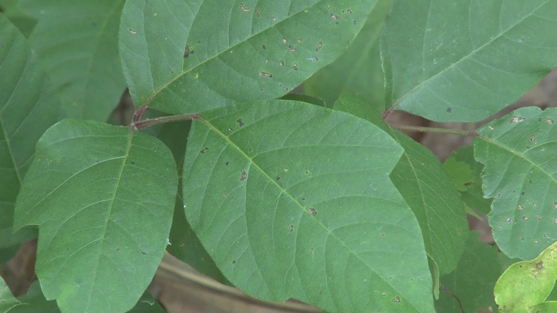 VERIFY Can poison ivy rash spread through contact with others