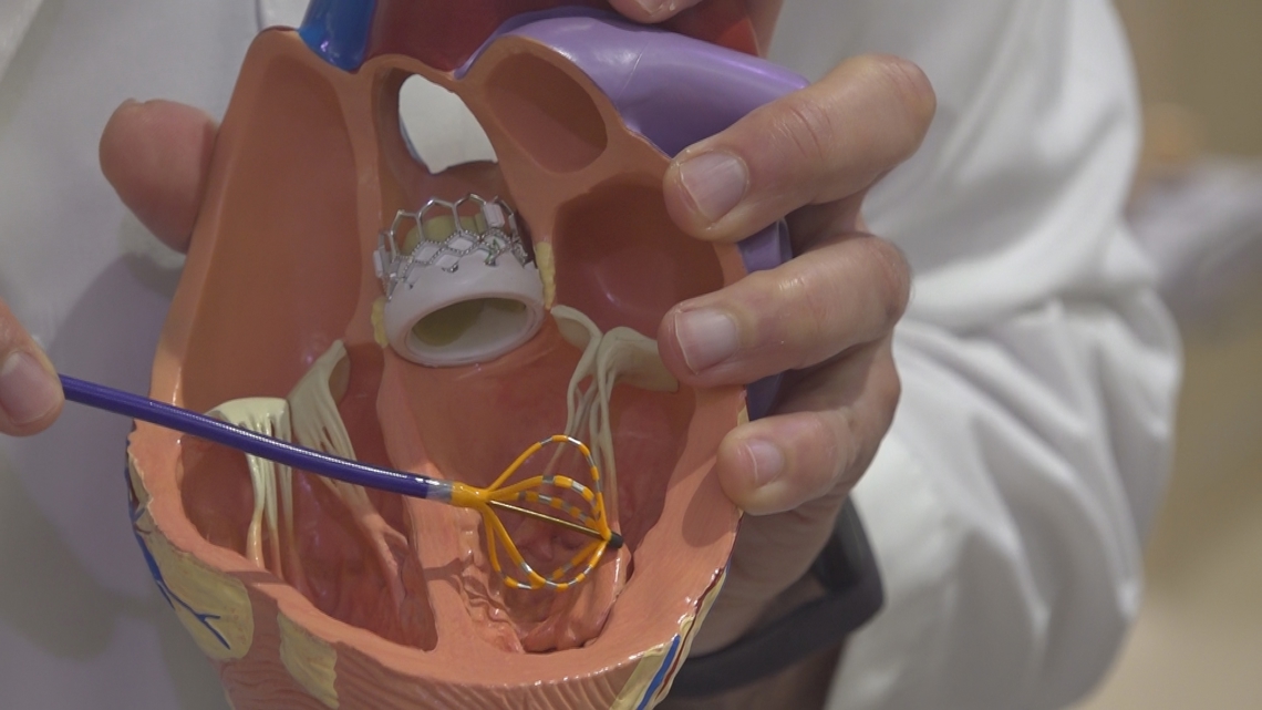 New procedure at Northern Light EMMC offers hope for people with irregular heartbeats