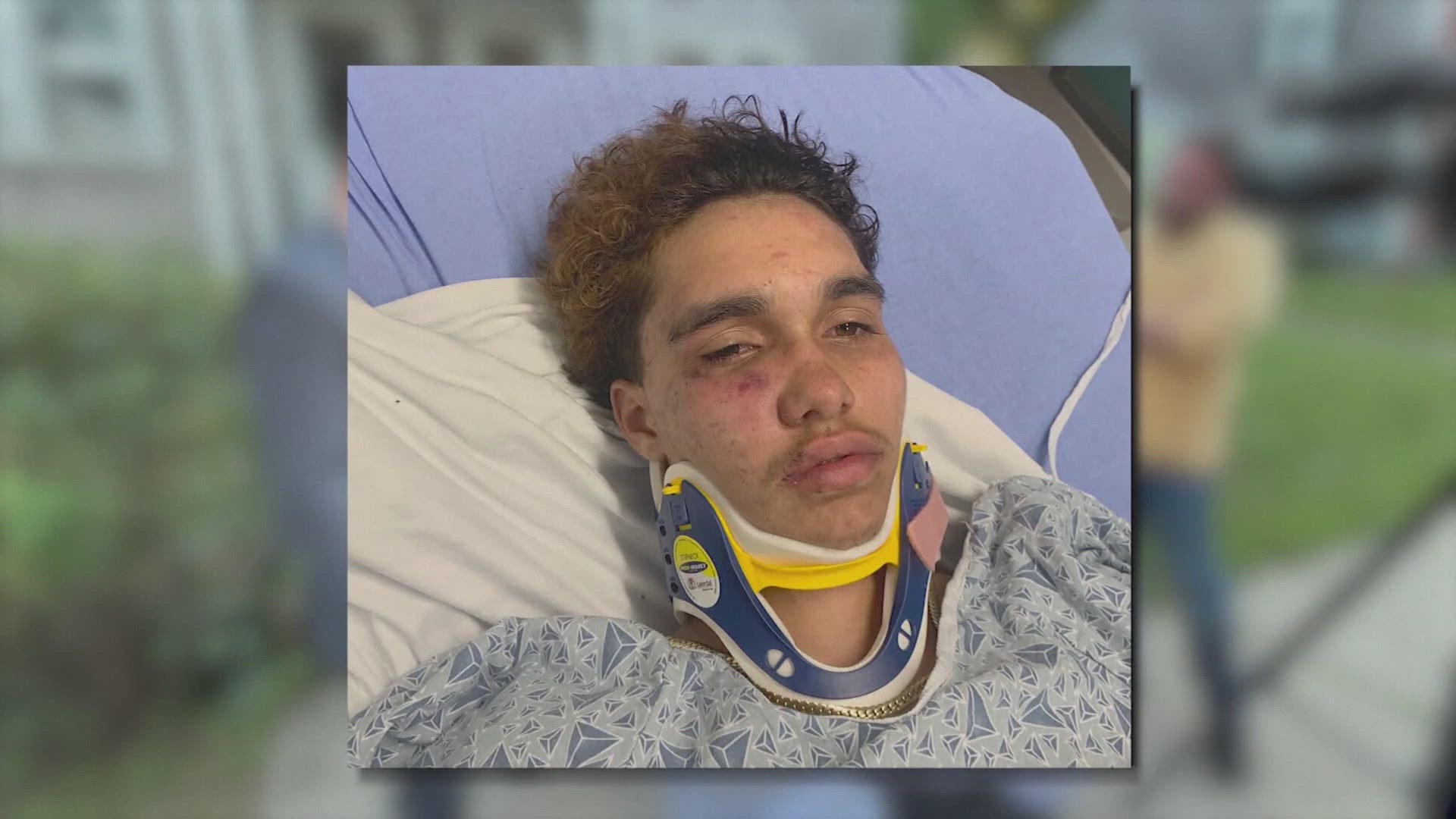 The 16-year-old teen is recovering from injuries suffered during the incident and said he has been bulled for years. Gloucester police are investigating.