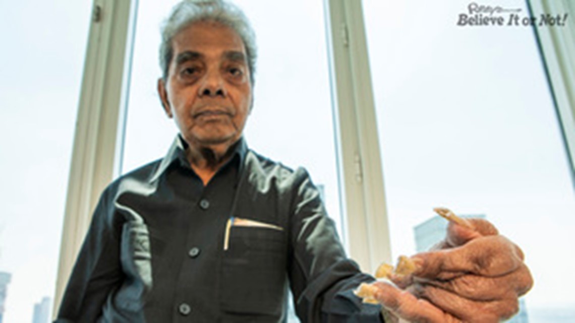 Guinness World record-holder for longest nails battles poverty | India News  - Times of India