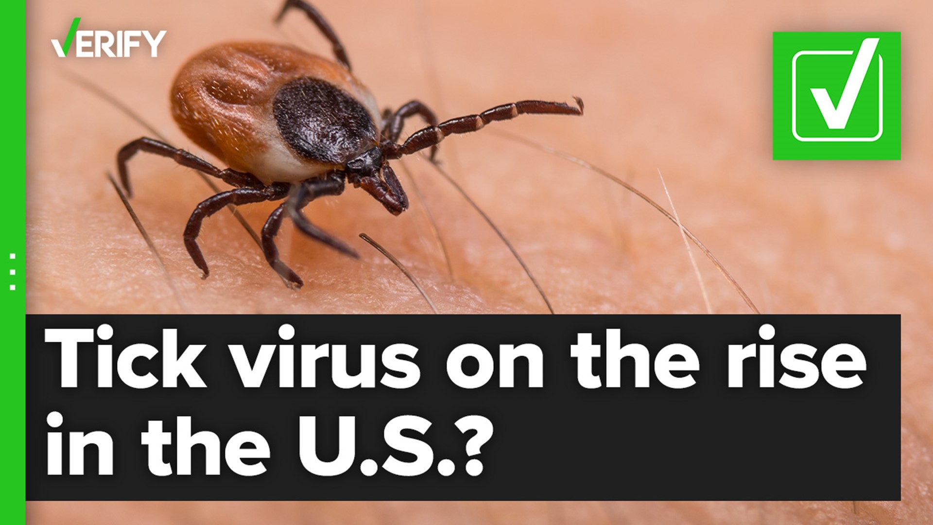 Powassan virus is usually spread through the bite of an infected black-legged or deer tick. The rare tick-borne illness can sometimes cause severe disease or death.