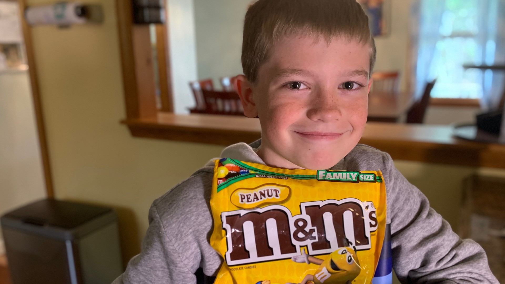Cole Labore has a severe peanut allergy but after working with medical professionals the 11-year-old  NOW he eats four peanuts a day to stave off his allergy.