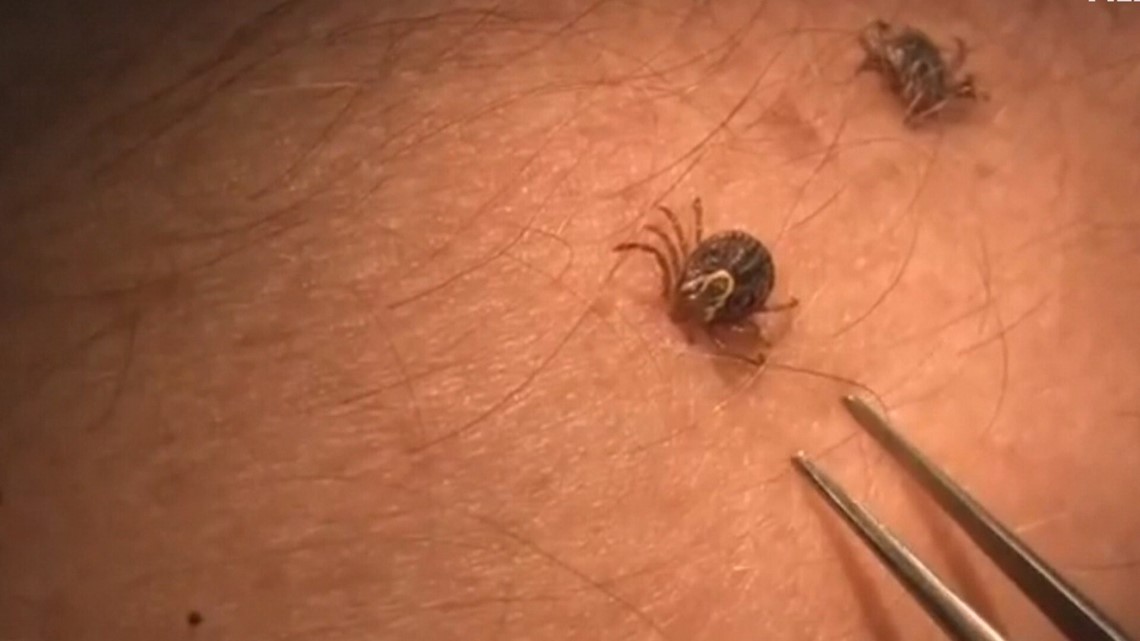 Deer ticks rebound following drought conditions this summer - Vimarsana News