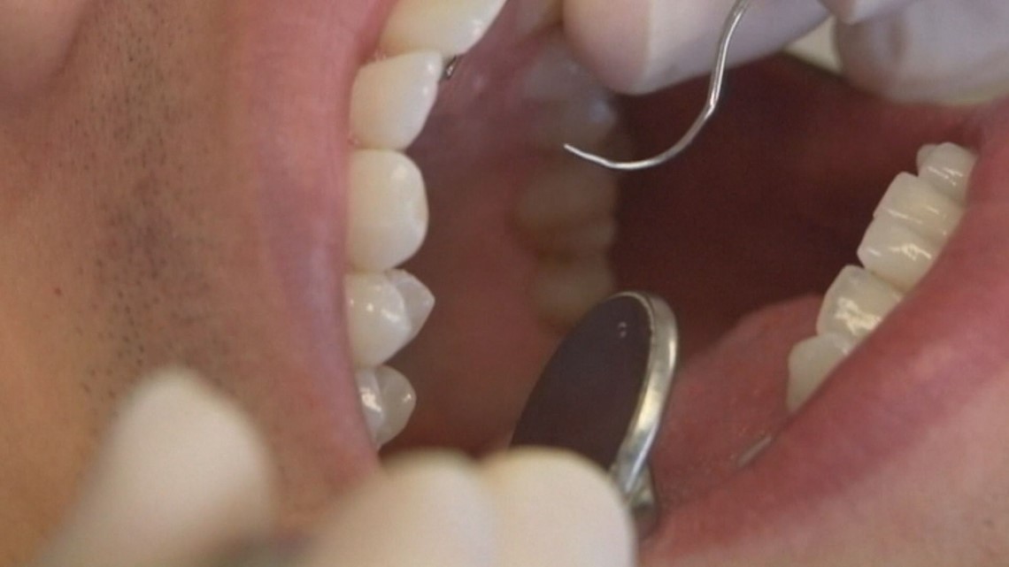 Cracked teeth, clenching jaw due caused by coronavirus stress