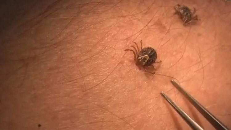 Climate change and ticks: Are they linked?