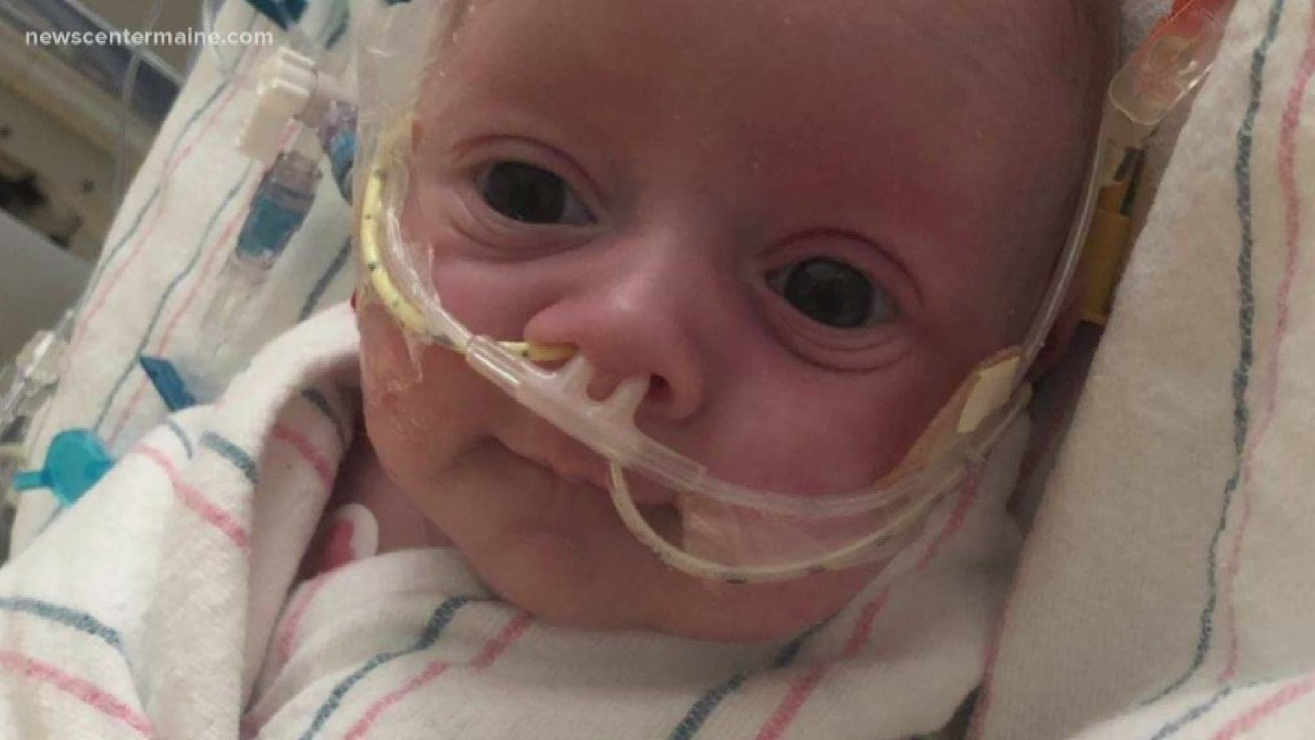 Baby Carson is recovering from a heart transplant after his brother died from the same condition he has nearly two years earlier.