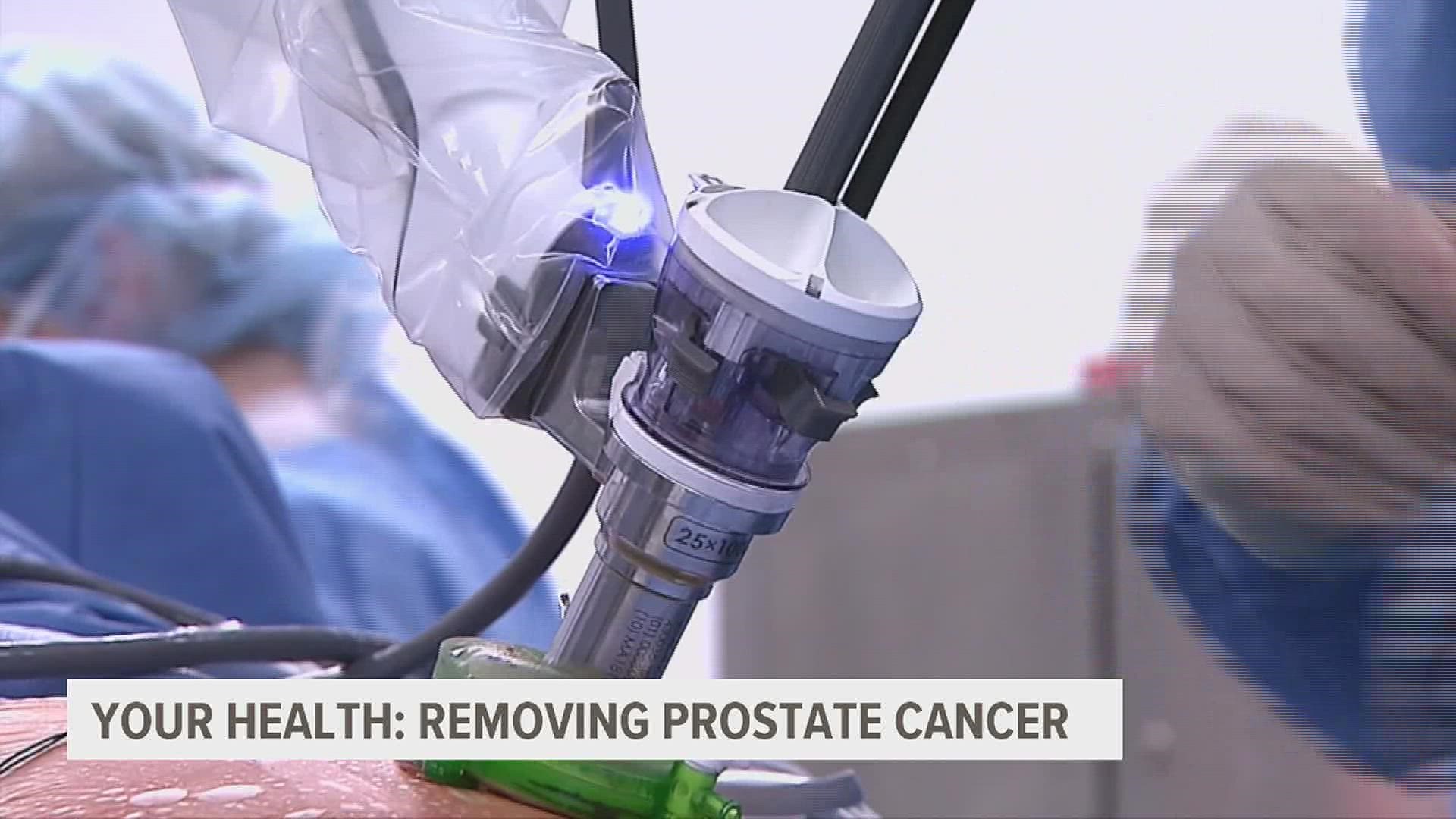 Doctors perform first-of-its-kind prostate cancer surgery ...