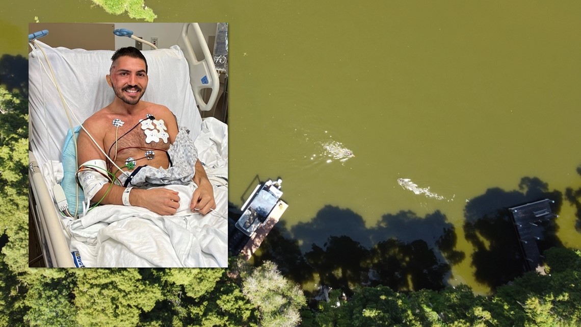 Florida man recounts alligator attack and his recovery journey ...